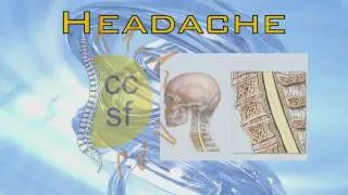 Headache Doctor Miami