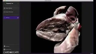 Digital heart walkthrough 1-  Normal heart | A 3D anatomy experience!