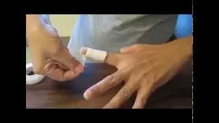 How to Clean your finger when you have a Mallet Finger Injury (Splint A)