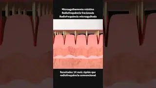 O Tonegold foi feito para voc&ecirc; 😍