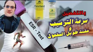 سرعة الترسيب ESR  تحليل الترسيب وعلاجه وحقنة بنسيلين طويل المفعول