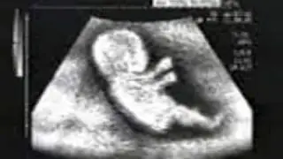 SEAT Baby echo