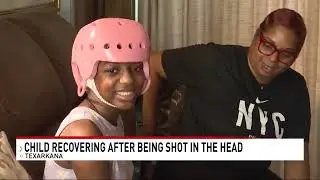 Texarkana child recovering after being shot in the head