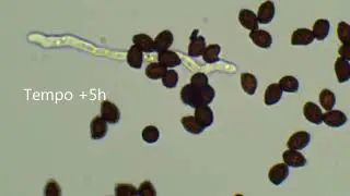 Germinazione spora del fungo Lacrymaria lacrymabunda
