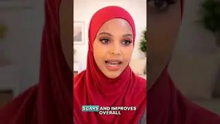 Microneedling for Acne Scars &ndash; REAL Results Explained