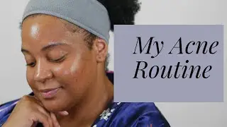 Acne Routine | ComfyChic365