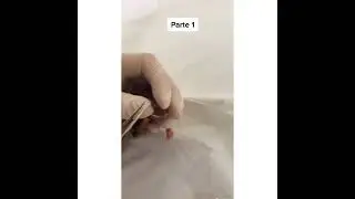 botfly removal in bird | mango worms removal | maggot botfly removal in rare bird