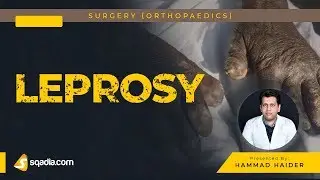 Leprosy | Orthopaedic Surgery | Clinical V-Learning Platform | sqadia.com