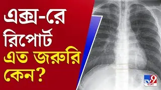 BC Roy Hospital: চাপের মুখে বিকল এক্স-রে মেশিন, প্রকাশ্যে স্বাস্থ্যব্যবস্থার হাড়গিলে চেহারা?