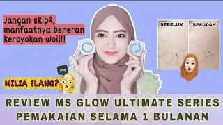 Review MS Glow Ultimate pemakaian 1 bulanan