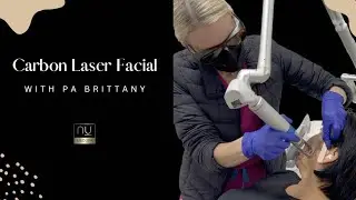 Carbon Laser Facial at NU Med Spa
