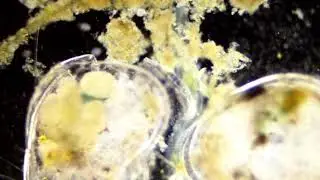 Pond water under microscope - segmented worm in darkfield illumination