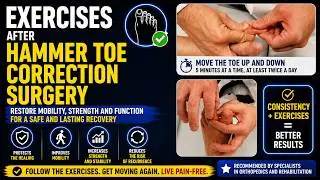 #28 Which  Exercises Help After Hammer Toe Surgery? Rehab Routine Explained