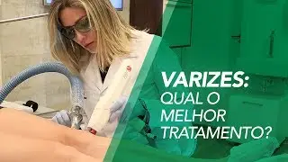 Qual o melhor tratamento de Varizes? - Dra. Livia Lyra - Angiologista em BH Responde