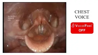 Discover VocalFeel®