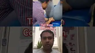 Tail Bone Alignment #feed #shortsviral #drrajneeshkant #chiropracticcare #comedy