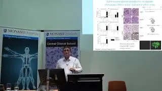 Professor Richard Kitching - determining the risk of autoimmune disease
