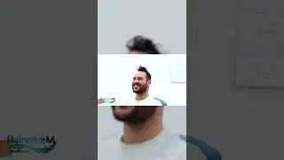 HairextreM | Hair transplant journey #hairtransplant   #greffedecheveux  #hairextrem