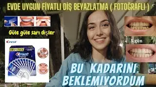 6 G&Uuml;NDE DİŞLERİM NASIL BEYAZLADI  | M&uuml;kemmel Diş Beyazlatma &Uuml;r&uuml;n&uuml; CREST