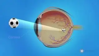 How the Eye Works