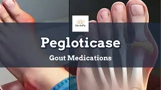 #pegloticase | Uses, Dosage, Side Effects & Mechanism | Krystexxa