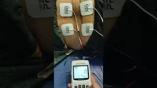Tens Therapy for nerve related  pain relief | TENS থেরাপি কি? | TENS থেরাপি কীভাবে কাজ করে?