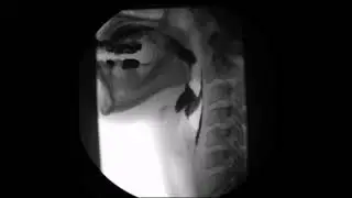 X-ray esophagus