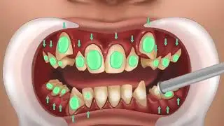 Relaxing ASMR Teeth Scaling: Gentle Dental Care Sounds