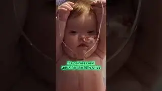 Did you see Babies get Xray? 👶🏻 #baby #xray #cute