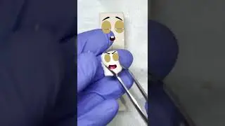Fudge gives birth | C-Section | Babies Birth 🥰😱| Food surgery | Fruit surgery #shorts