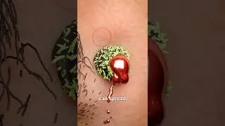 Shaving Over A Mole 😬