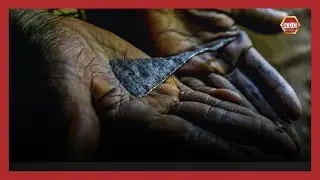 Three women hospitalised in Kericho after a botched circumcision