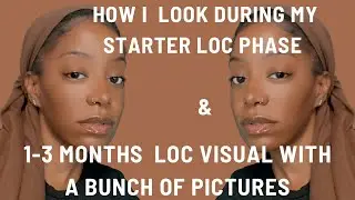 Starter Locs On Short Hair Journey To Confidence| #locs #locjourney