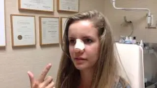 No Breathing Problems after Rhinoplasty With The Kotler Nasal Airway