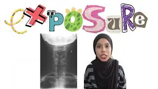 AP CERVICAL PROJECTION