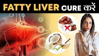 Reverse Fatty Liver Permanently | कैसे करें Fatty Liver का इलाज