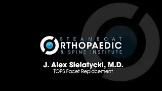 TOPS Facet Replacement by SOSI
