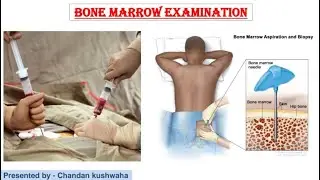 Bone Marrow Examination , bone marrow staining