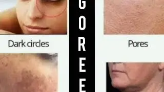Skin problems Solution only goree order on description link cash on delivery 100% original