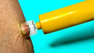 15 LIFE SAVING Inventions You Need To See!