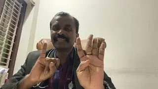Rat bite treatment
