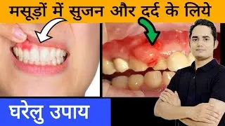 Masudon Me Dard Aur Sujan Ke Liye Gharelu Nuskhe !! Gum Problems Home Remedies