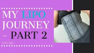 My Liposuction Journey - Lipo 360 - Part 2