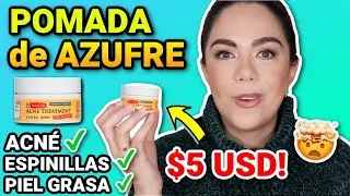 LA POMADA SÚPER BARATA QUE CURA EL ACNÉ EN SÓLO 10 MINUTOS ✅ | MARIEBELLE COSMETICS