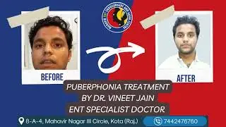 ?puberphonia Treatment In India Best Doctor For Puberphonia Treatment Honest Video