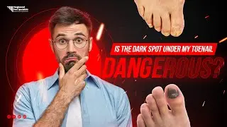 Is the Dark Spot Under My Toenail Dangerous?
