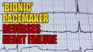 Revolutionary &lsquo;Bionic&rsquo; Pacemaker Capable Of Reversing Heart Failure Now Set For Human Trials