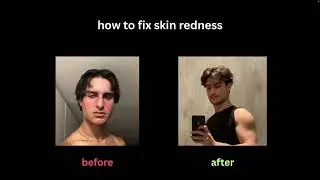 how to fix skin redness from rosacea