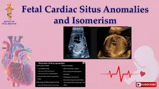 Fetal Cardiac Situs Anomalies and Isomerism