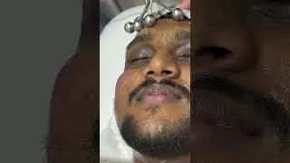 HydraFacial Treatment#headandfaceunisexsalonkochi